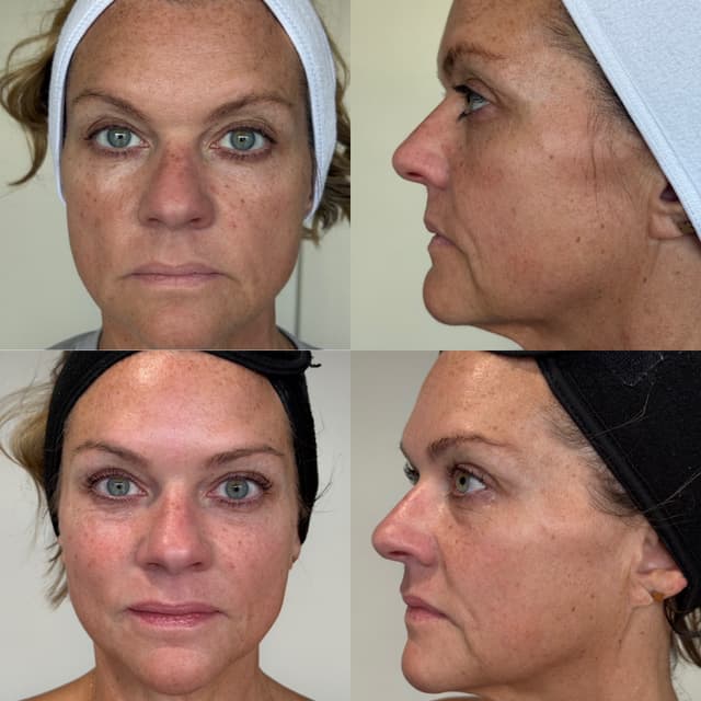 SWiCH Treatment (3) at Illuminate Lashes and Beauty in Trussville, AL